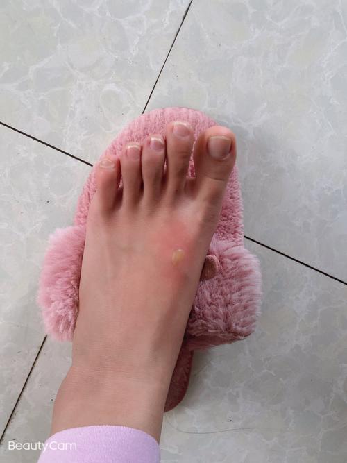 暖水袋烧了会臭怎么办-第3张图片-索能光电网