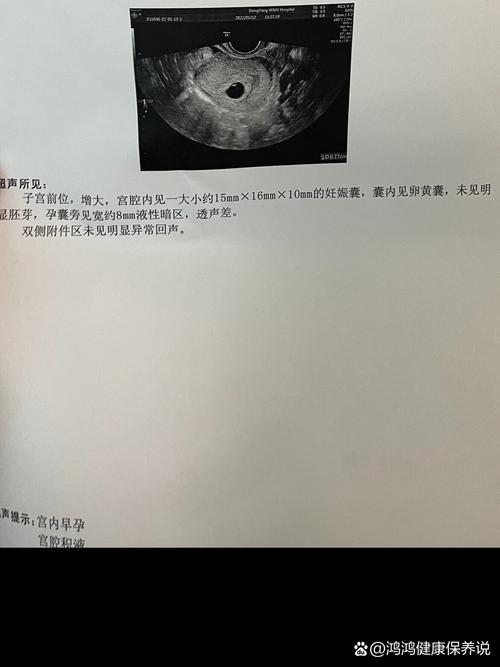 依玛出现10是故障提示还是特定模式?-第2张图片-索能光电网 依玛出现10是故障提示还是特定模式?-第2张图片-索能光电网