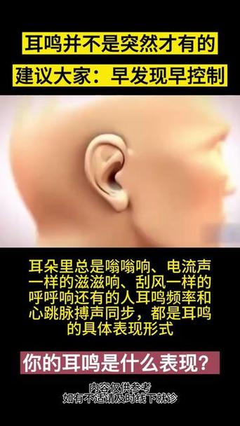 喇叭嗡嗡声是何原因导致?-第3张图片-索能光电网 喇叭嗡嗡声是何原因导致?-第3张图片-索能光电网