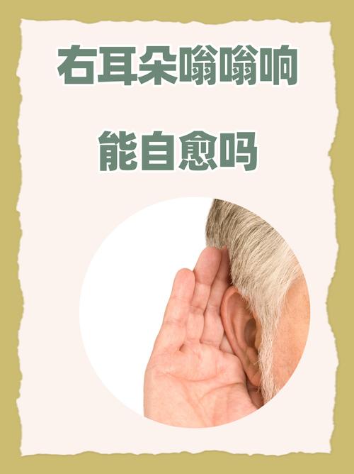 喇叭嗡嗡声是何原因导致?-第2张图片-索能光电网 喇叭嗡嗡声是何原因导致?-第2张图片-索能光电网